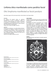 Linfoma ótico manifestado como parálisis facial Otic limphoma