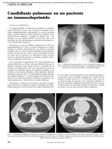 Candidiasis pulmonar en un paciente no inmunodeprimido