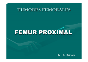 Cirugía Fémur Proximal