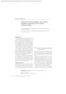 Calcificación arterial idiopática de la infancia