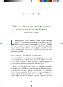 Dermatitis herpetiforme y otras manifestaciones cutáneas