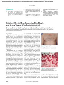 Unilateral Nevoid Hyperkeratosis of the Nipple and Areola