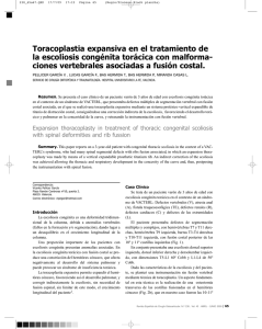 Toracoplastia expansiva en el tratamiento de la escoliosis