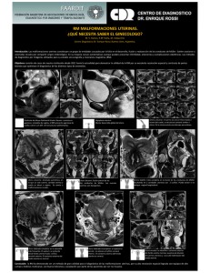 resonancia magnética en el diagnóstico de malformaciones uterinas.