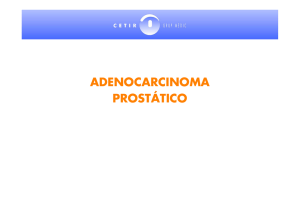 adenocarcinoma prostático