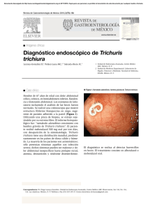 Diagnóstico endoscópico de Trichuris trichiura
