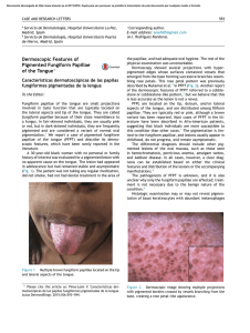 Dermoscopic Features of Pigmented Fungiform Papillae of
