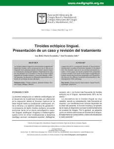 Tiroides ectópico lingual. Presentación de un caso