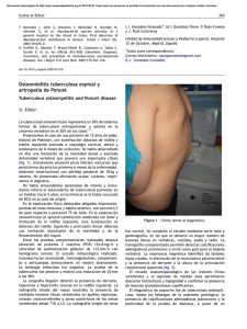 Osteomielitis tuberculosa espinal y artropatı´a de Poncet