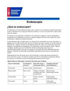 Endoscopia - American Cancer Society
