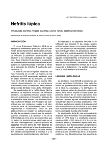 Nefritis lúpica