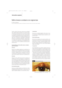 Infecciones oculares en urgencias