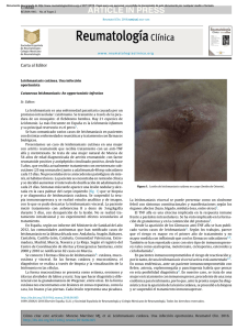 article in press - Reumatología Clínica