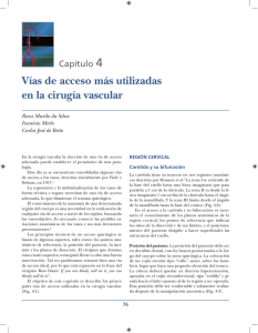 Vías de acceso más utilizadas en la cirugía vascular