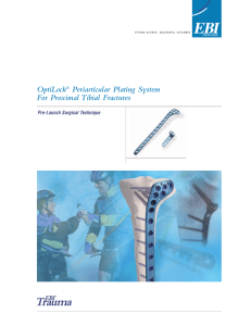 OptiLock® Periarticular Plating System For Proximal Tibial Fractures