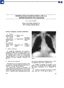 Semiologia radiologica de la hipertension pulmonar