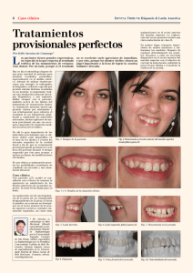 Tratamientos provisionales perfectos