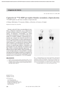 Captación de 99mTc-HDP por tejidos blandos secundaria a