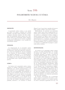Tema 106 PANARTERITIS NUDOSA CUTÁNEA