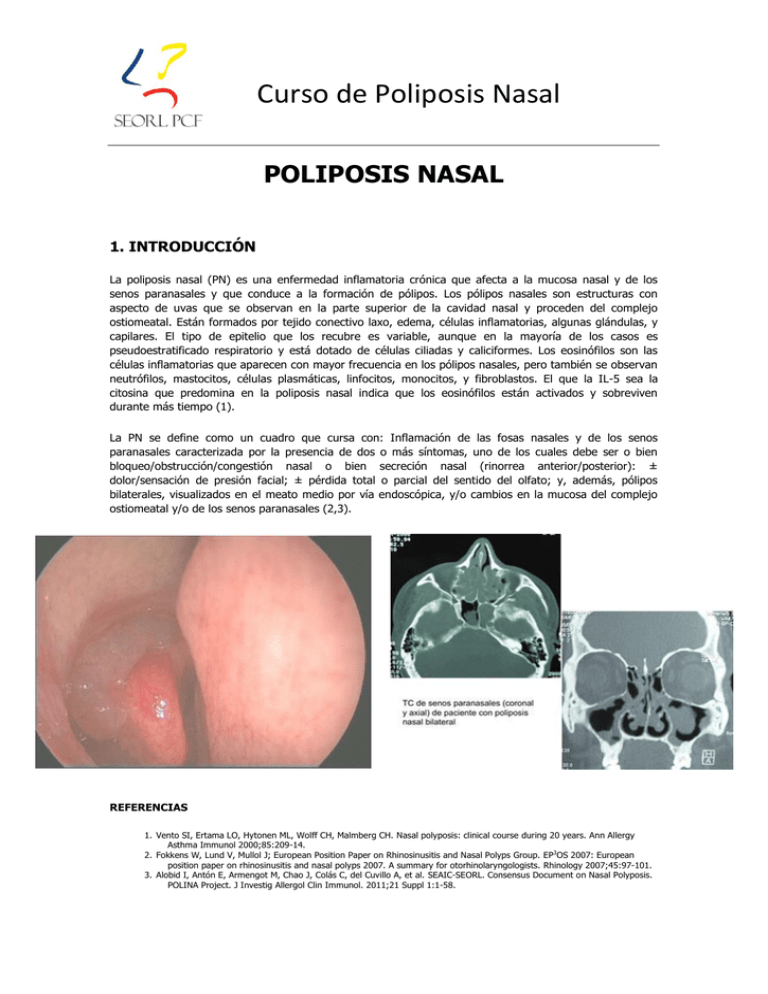 curso-de-poliposis-nasal