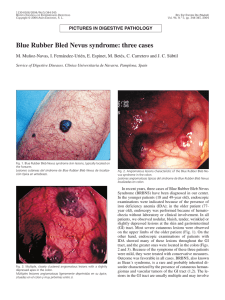 Blue Rubber Bled Nevus syndrome: three cases