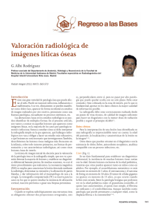 Valoración radiológica de imágenes líticas óseas