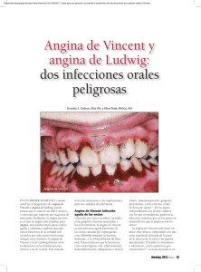Angina de Vincent y angina de Ludwig: dos infecciones orales