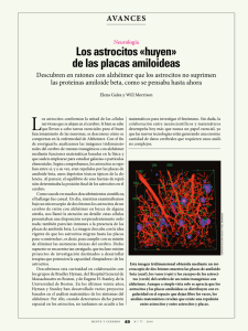 Los astrocitos «huyen» de las placas amiloideas