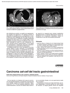 Carcinoma oat-cell del tracto gastrointestinal