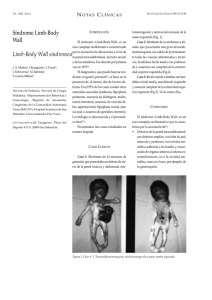 Síndrome Limb-Body Wall Limb