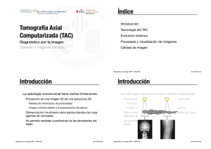 Tomografía Axial Computarizada (TAC) Índice Introducción
