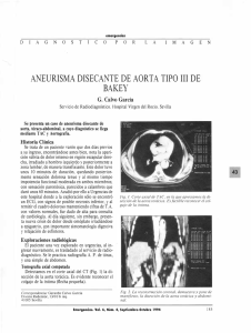 aneurisma disecante de aorta tipo iii de bakey