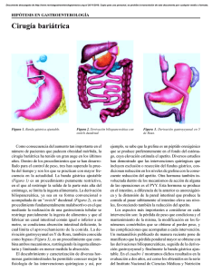 Cirugía bariátrica - Revista de Gastroenterología de México