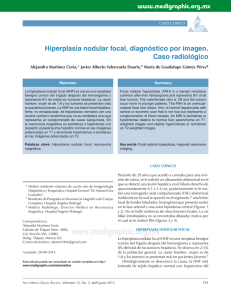 Hiperplasia nodular focal, diagnóstico por imagen