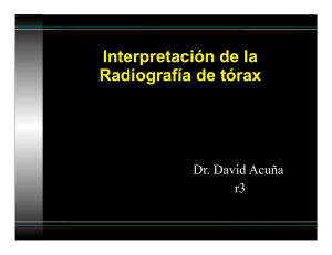 Interpretación de la Radiografía de tórax