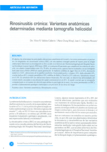 Rinosinusitiscrónica:Variantesanatómicas