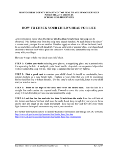 how to check your child`s head for lice
