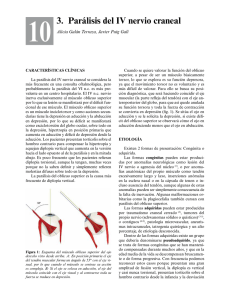 3. Parálisis del IV nervio craneal
