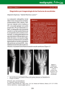 Diagnóstico por imagenología de las fracturas de