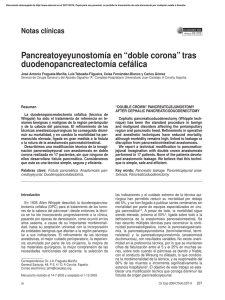 Pancreatoyeyunostomía en “doble corona” tras