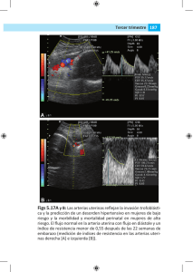 Tercer trimestre Figs 5.17Ay B: Las arterias uterinas reflejan la