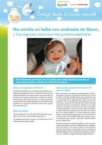 Ha nacido un bebé con síndrome de Down