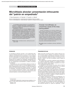 Microlitiasis alveolar: presentación infrecuente del “patrón en