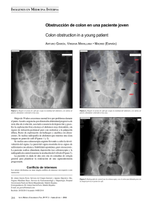 Obstrucción de colon en una paciente joven Colon obstruction in a