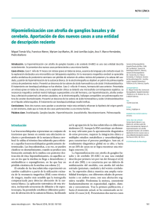 Hipomielinización con atrofia de ganglios basales y de cerebelo