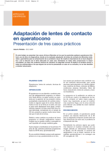 Adaptación de lentes de contacto en queratocono