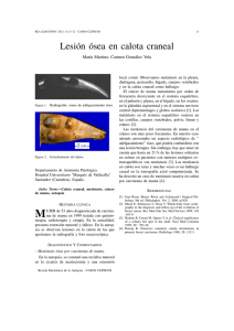 Lesión ósea en calota craneal - Revista Electrónica de Autopsia