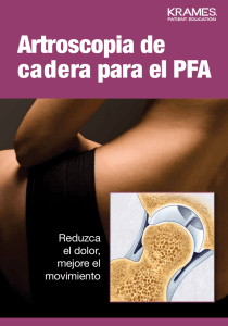 Artroscopia de cadera para el PFA
