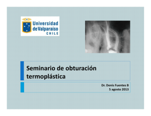 Obturacion Termoplastica - Postgrado de Odontologia