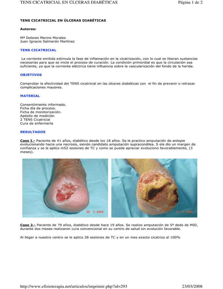 Página 1 De 2 Tens Cicatricial En Úlceras DiabÉticas 23 0881